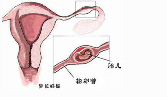 苏州捐卵者机构排名,              苏州做结扎复通手术去哪个三甲医院最好？